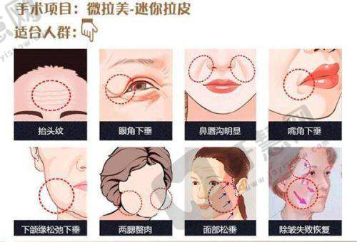 合肥做双眼皮重要医生之孙洋