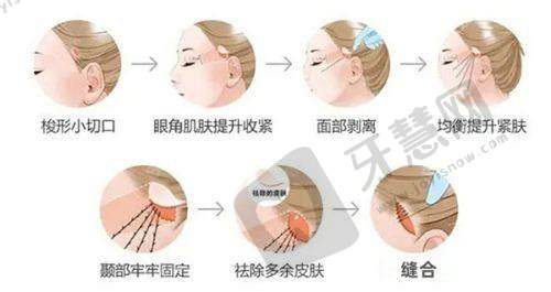 西安伊美尔医疗美容医院曝光口碑好不好？真实用户评价+收费合理性揭秘