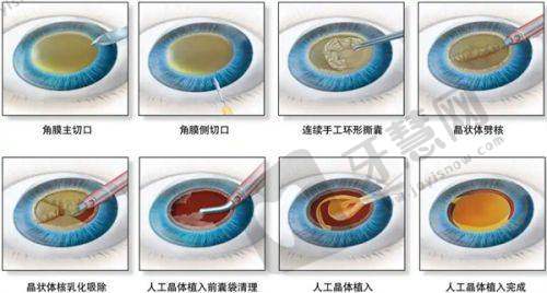 三、武汉艺星徐国建的技术优势