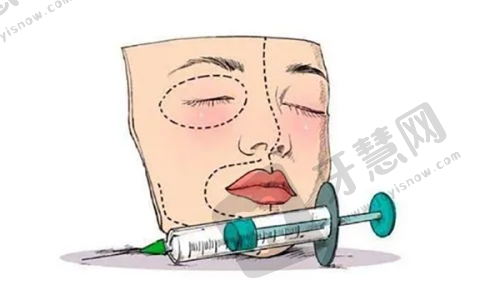 总结合肥双眼皮修复更好的医生