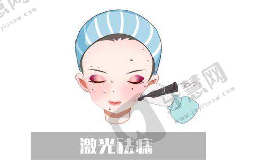 合肥双眼皮修复周瑜做的好吗？15年经验+超5000例案例，口碑极佳预约难