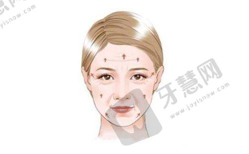 南京隆鼻哪里效果好？美莱/连天美/华美等医院医生技术优价格合理