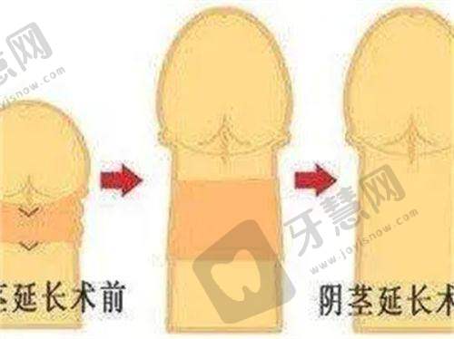 合肥双眼皮曹林咋样之审美风格