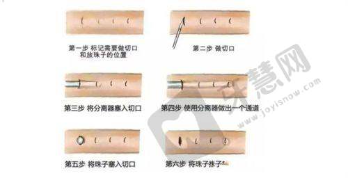 上海长海医院整形外科真人口碑评价怎么样？