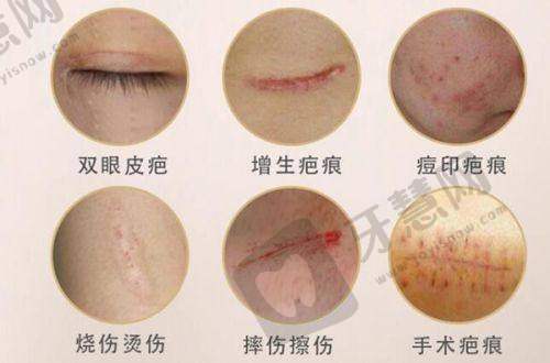 南京吸脂去哪家——南京康美美容医院