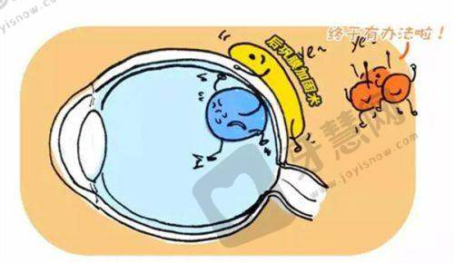 郝俊华医生巩膜后兜带术技术原理