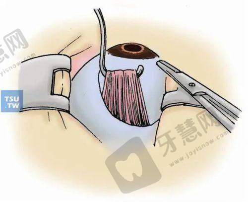 眼科医院医生团队实力如何
