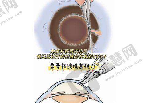 眼科医院设备配置怎么样