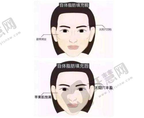 南宁种植头发哪家医院好呢——选择医院的逻辑参考