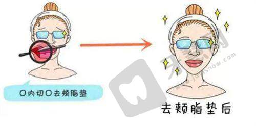 长沙哪家医美做的更好之长沙协雅医疗美容门诊部