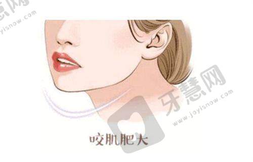 长沙哪家医美做的更好之长沙美莱医疗美容医院