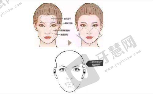 贵阳隆鼻排名前十的医生之骆显红