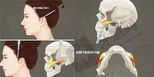 贵阳整形医院排行榜之综合实力前十医院