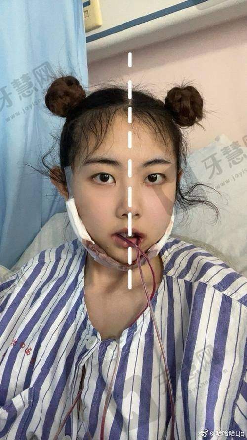 东莞虎门齿兰口腔(虎门长堤院区)口碑如何