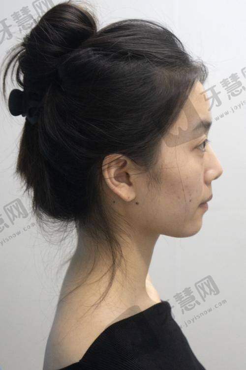 东莞长安安美聚光医疗美容门诊部收费贵吗？