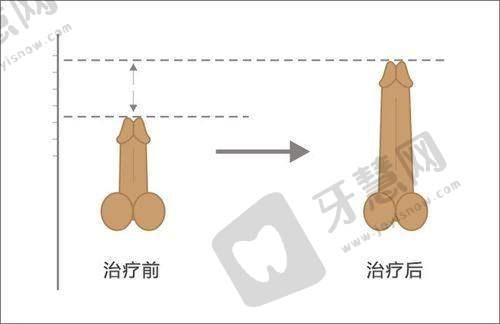 梅州曙光医疗美容医院收费价格表/收费标准