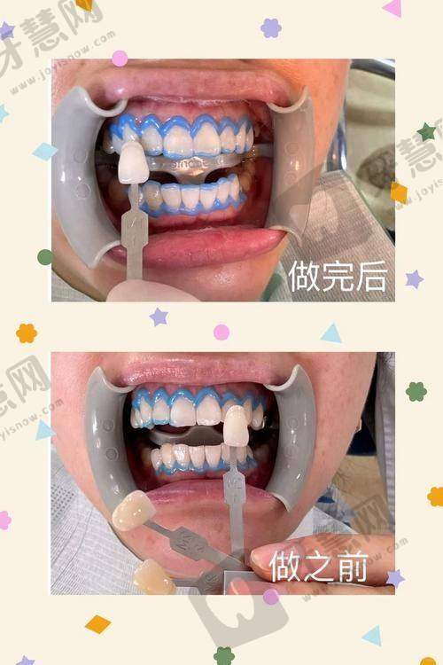 上海德TSK齿科上海德信会口腔门诊部（高岛屋诊所）特色项目及技术优势