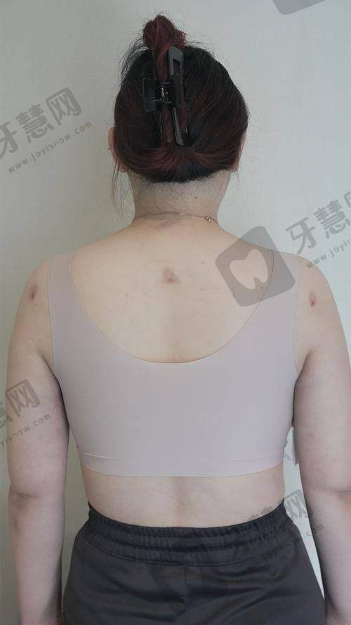  佛山顺德爱汇星希斯医疗美容医院是国有的吗？