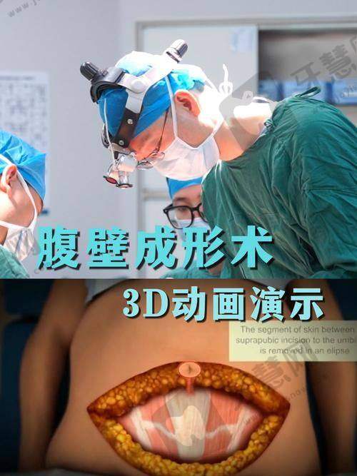 佛山复星禅诚医院整形外科正规吗？