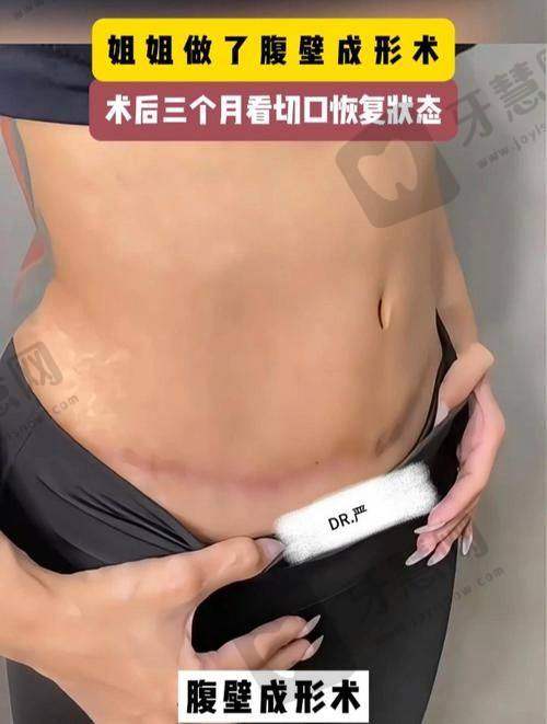 东莞爱思特医疗美容门诊（原华美）预约挂号