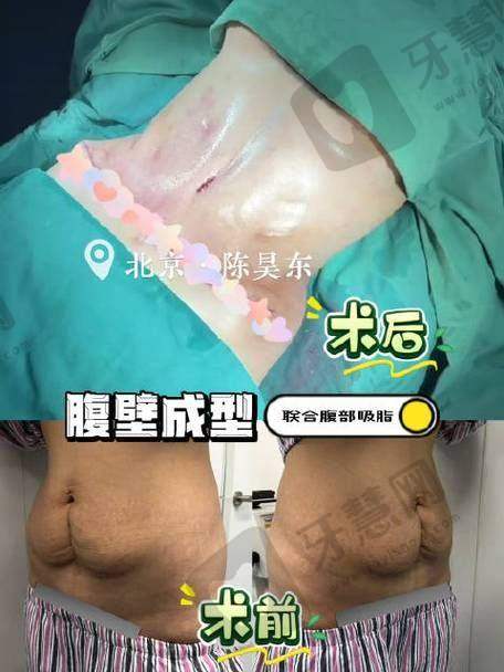 东莞伊然医疗美容医院是国有的吗？