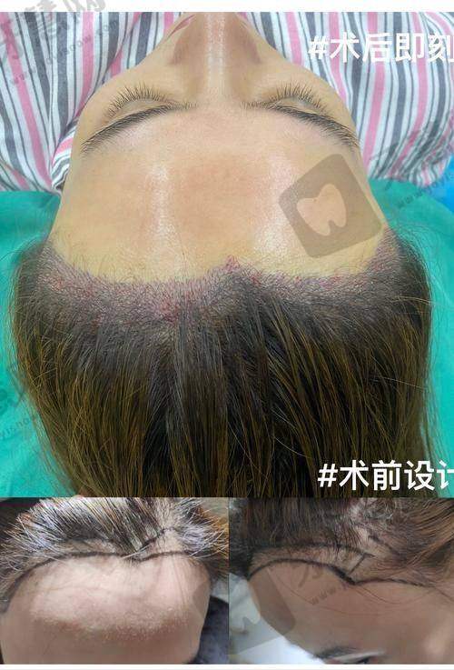 佛山第一人民医院烧伤整形科口碑如何