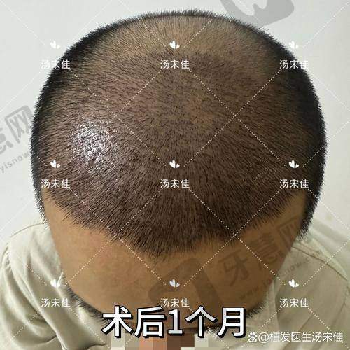 沈阳华美植发医院预约挂号