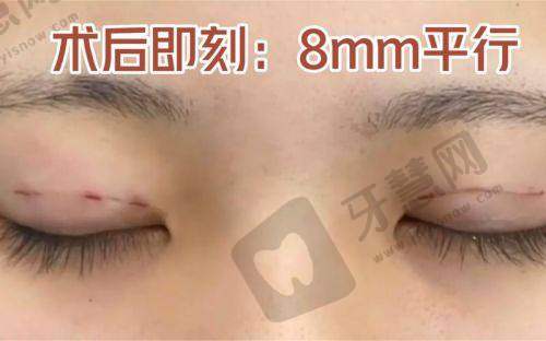 东莞伊然医疗美容医院正规吗？