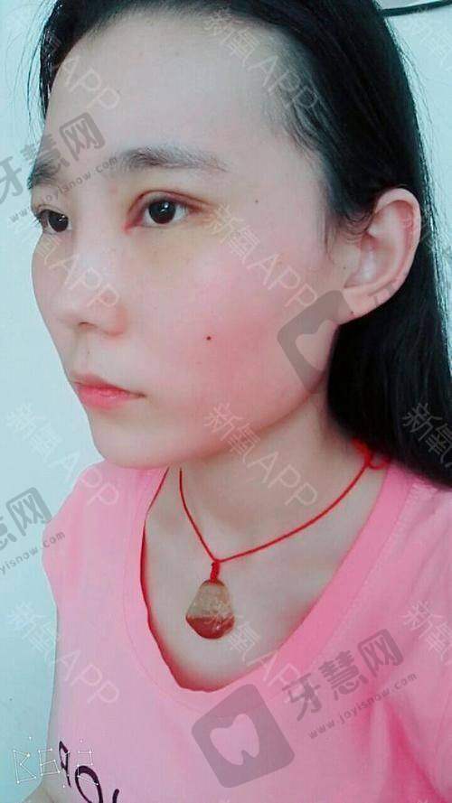 东莞长安安美聚光医疗美容门诊部预约挂号