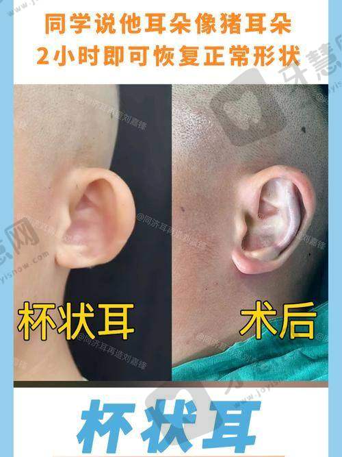 佛山复星禅诚医院整形外科预约挂号
