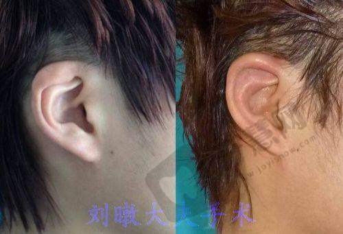佛山禅医激光美容皮肤科口碑如何？