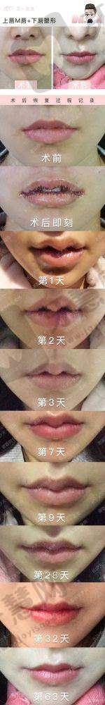  佛山顺德爱汇星希斯医疗美容医院地址电话