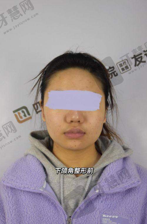 宁波珈禾整形专科医院是正规医院吗?