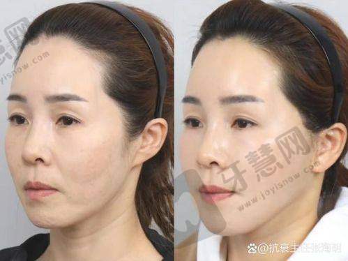 东莞爱思特医疗美容门诊（原华美）地址电话