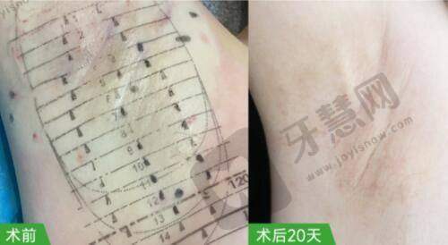 邯郸华美医疗美容医院是正规医院吗?