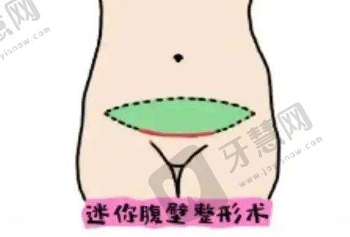 2025农村老人白内障免费申请流程大更新!三证齐全7天拿补助,错过再等一年——避坑指南要牢记