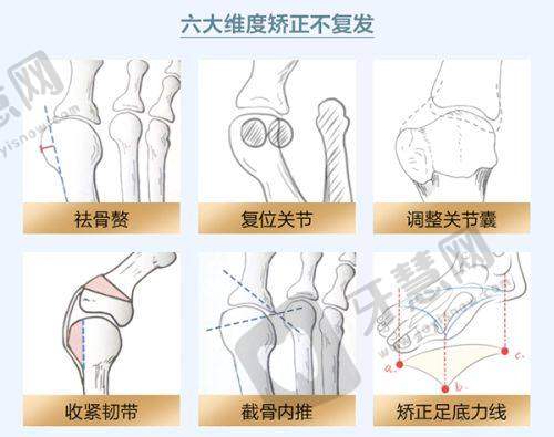 曝光!广州南方医院整形美容科2025价目表——胸部整形项目