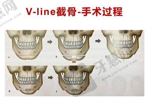 呼和浩特韩赋医疗美容医院特色项目及技术优势