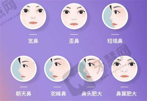 【脸部医生免费问诊24小时在线】1对1解答面部提升问题