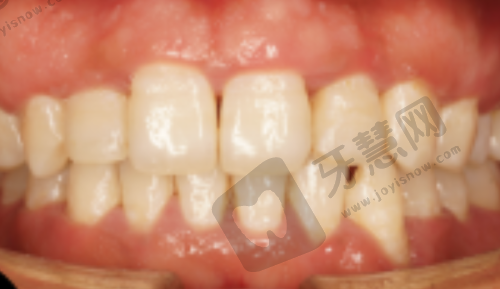 福州维乐口腔：大型连锁，技术不错