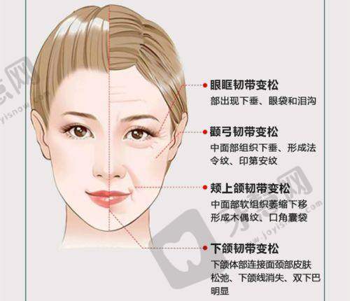 腋臭手术后会复发吗？miradry微波复发率低，四类人慎选/洛阳三院技术优