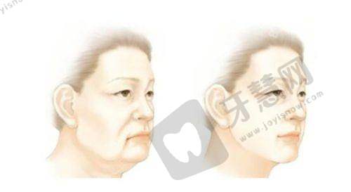 杭州韩美整形在杭州韩式整形方面的特色