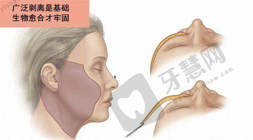 石家庄碧莲盛植发医院诊疗项目：