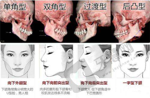 刚去看了广大口腔医院的用户反馈，才知道原来广大口腔在广州真是有口皆碑——综合看牙体验