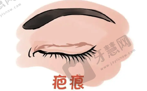 2025农村老人白内障免费申请流程大更新!三证齐全7天拿补助,错过再等一年——申请流程全知晓