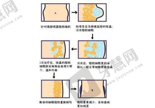 上海艺星医疗美容医院收费价格表/收费标准