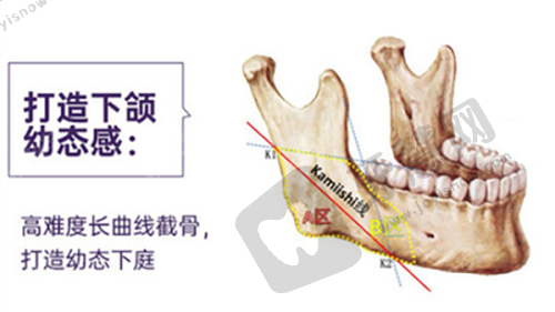 二、武汉其他有名双眼皮修复医生