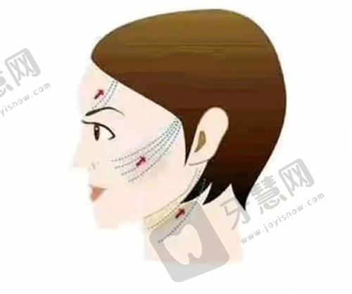 【鼻子整形在线询问】——助力你做出明智决策