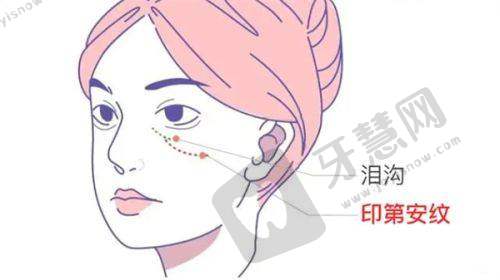 泉州碧莲盛植发医院预约挂号方式: