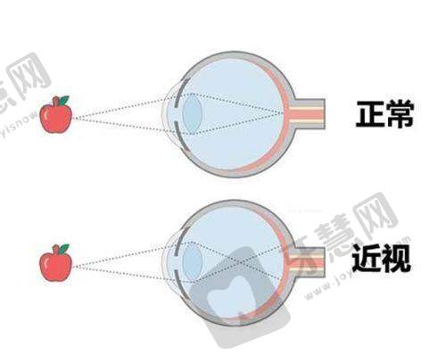 上海和平眼科医院